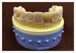 CAD/CAM　スプリニティ